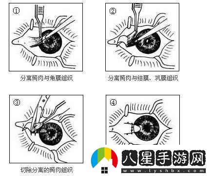 獲得超級胬肉系統怎么辦