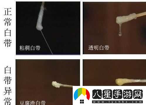 白色液體流出且睡不著(zhù)咋回事