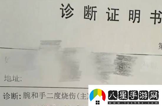 女子睡覺(jué)時(shí)充電中的手機突然爆炸導致二度燒傷