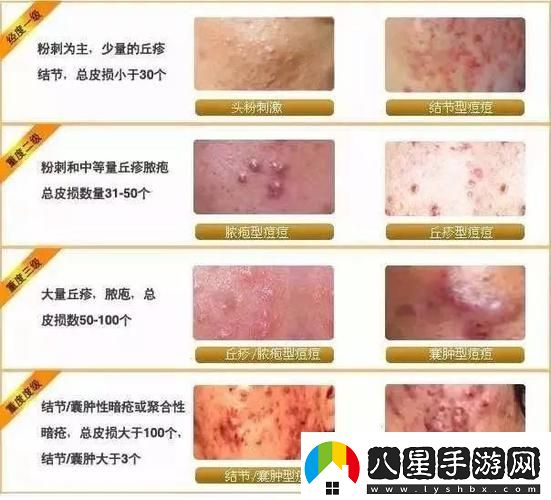 女性三角毛毛區長(cháng)了個(gè)硬疙瘩