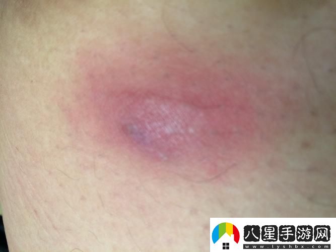 科技江湖突現「身體疙瘩俠」