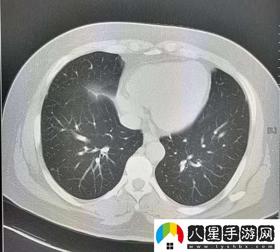 男配每天都在體內成結節