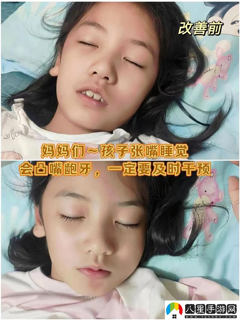 深入解析“小嘴無(wú)力合攏紅腫外翻圖片”背后的醫學(xué)意義